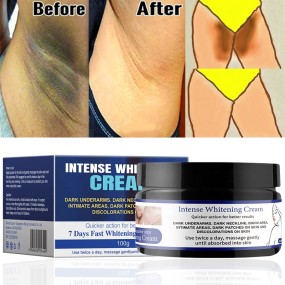 Whitening Cream Supplier - OEM Intense Face Body Underarm Bleaching