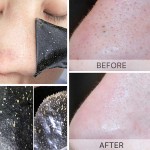 Blackhead Remover Supplier - OEM 3 Step Nose Acne Clean Beauty Kit
