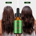 Hair Oil Supplier - OEM Biotin Rosemary Promote Growth Strengthen