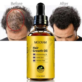 Hair Oil Manufacturer - OEM Custom Fast Growth Anti Loss Organic
