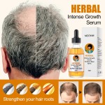 Hair Oil Factory - OEM Perfect Natural DHT Blocker Vitamins