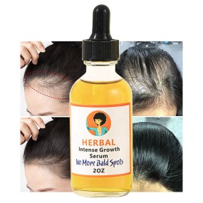 Hair Oil Manufacturer - OEM Most Sold Scalp Repair Anti Falling