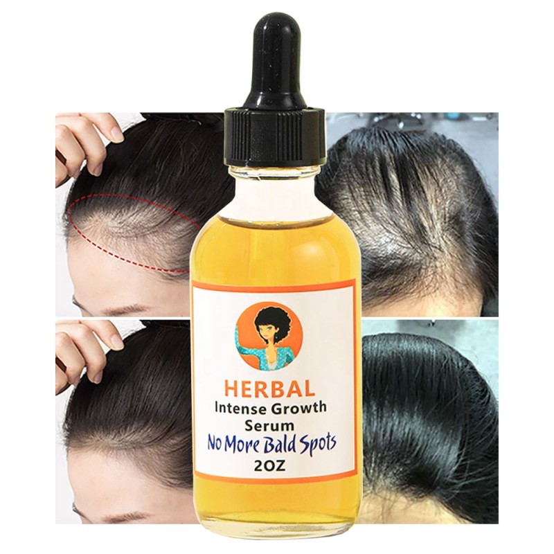 Hair Oil Manufacturer - OEM Most Sold Scalp Repair Anti Falling
