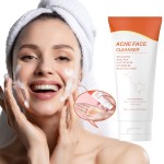 Acne Face Wash Factory - OEM Natural Tea Tree Salicylic Acid Cleanser