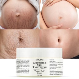 Stretch Mark Cream Factory - OEM Anti Wrinkle Pregnancy Scars Repair