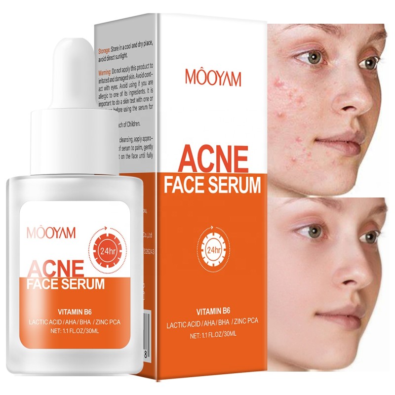 Acne Serum Supplier - OEM Soothing 1% Zinc PHA Facial Care