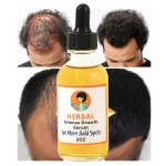 Hair Essence Supplier - OEM 30ml Natural Ginger Germinal Oil