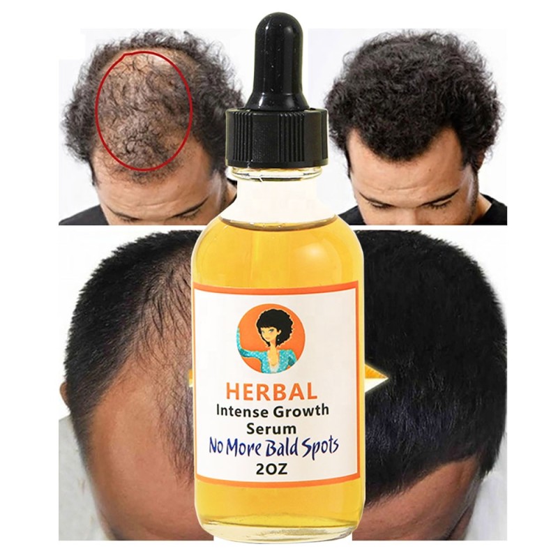 Hair Essence Supplier - OEM 30ml Natural Ginger Germinal Oil