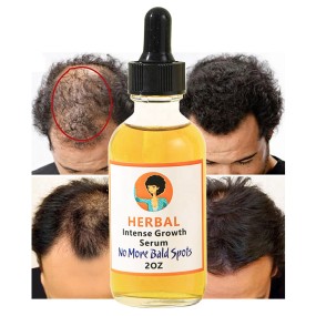 Hair Oil Factory - OEM Natural Vegan Nourishing Anti-hair Loss