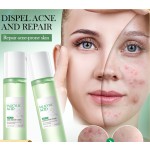Salicylic Acid Lotion Supplier - OEM Dark Spot Repair Acne Gel Moisturizing
