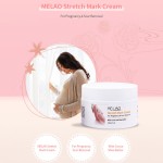 Stretch Marks Cream Supplier - Pregnancy Scars Organic Lavender Remove