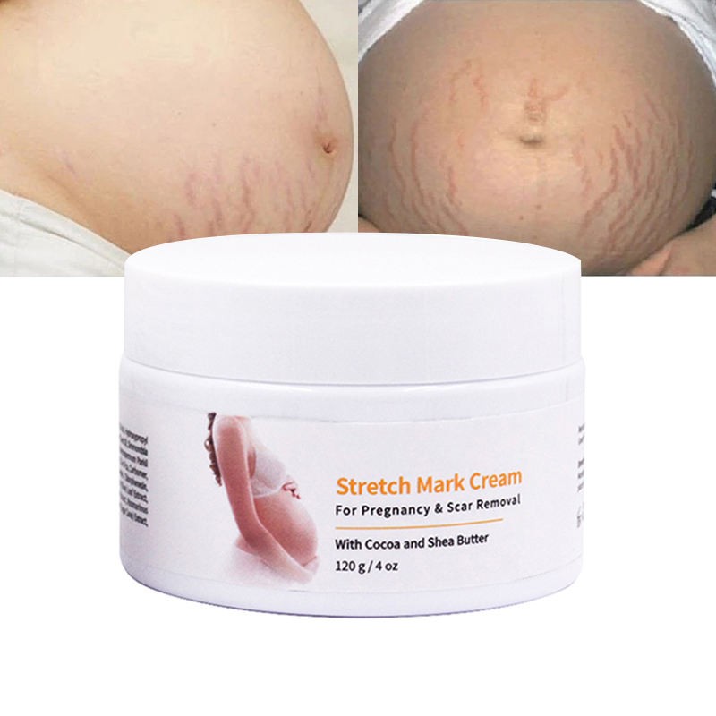 Stretch Marks Cream Supplier - Pregnancy Scars Organic Lavender Remove