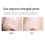 Blackhead Remover Supplier - Customize logo Nose Strips for Remove Dirt Oil