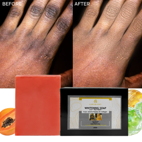 OEM Custom Logo Organic Vitamin C Skin Whitening and Exfoliating Handmade Soap Knuckle Whitening Kojic Acid Soap for Dark Skin