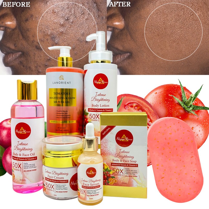 Private Label Korean Organic Skin Care Cosmetics Vitamin C Skin Whitening Moisturizing Removing Dark Spots Tomato Skin Care Set