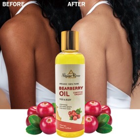 Private Label Vitamin C Skin Whitening Removing Dark Spot Arbutin Oil Organic Toning Bearberry Massage Oil for Black Skin