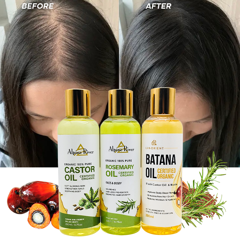Private Label Organic Vitamin E Scalp Care Products Rosemary Hair Nourishing Moisturizing Batana Hair Growth Oil for Women