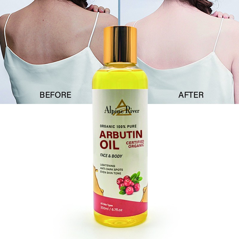 Tiktok Sells Natural Organic Vitamin C Skin Arctoside Oil to Remove Dark Spots and Lighten Skin Bearberry Oil for Adult