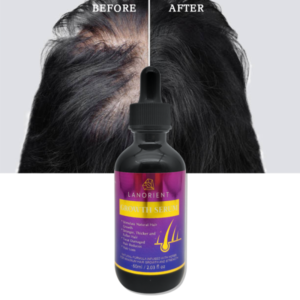 2024 New Natural Organic Rosemary Oil Hair Growth Hair Treatment Hair Growth Serum