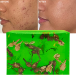 Private Labels Vitamin C Skin Care Exfoliating Tea Tree Handmade Soap Bath Soap for Anti-Acne