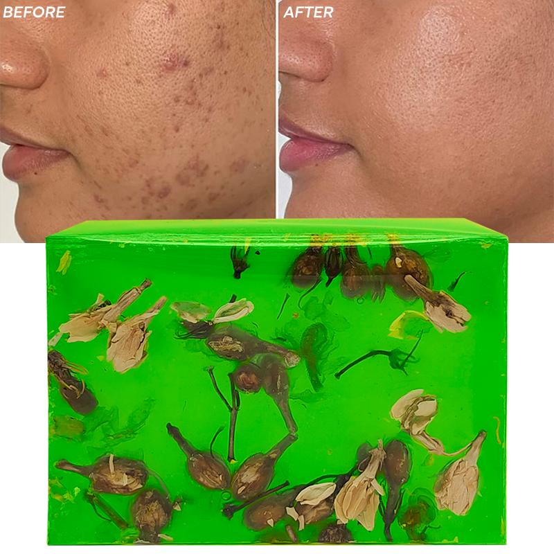 Private Labels Vitamin C Skin Care Exfoliating Tea Tree Handmade Soap Bath Soap for Anti-Acne