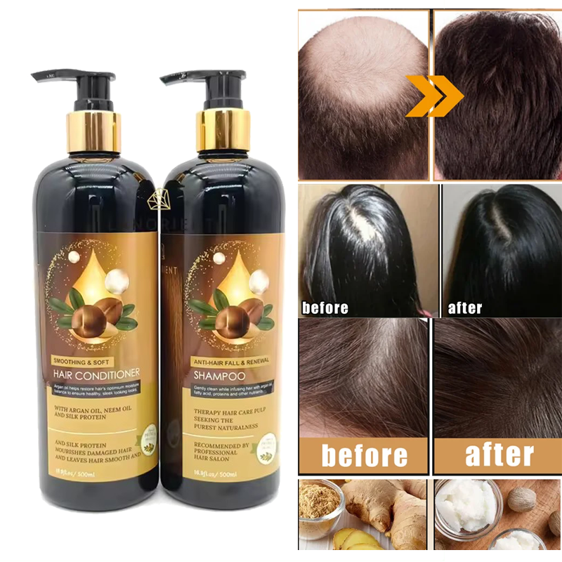 LANORIENT Shampoo for Hair Growth Anti-Hair Loss Oil Control Shampoo Professional Repair Damage 500ml Hair Growth Kit