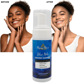 Private Label Organic Vitamin C Skin Whitening, Blackhead Removing Moisturizing Turmeric + Kojic Acid Brighten Facial Cleanser