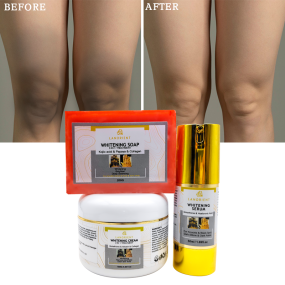 Private Label LANORIENT Arbutin Knuckle Spot Removal Whitening Skin Care Set Natural Organic Vitamin C Collagen Skin Care Set