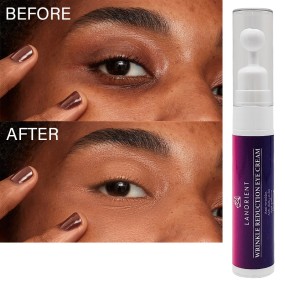 OEM Wholesale Vitamin C Facial Care Products Eye Bag Removal Cream Anti-Wrinkle Removal Retinol Ball Eye Cream for Adults