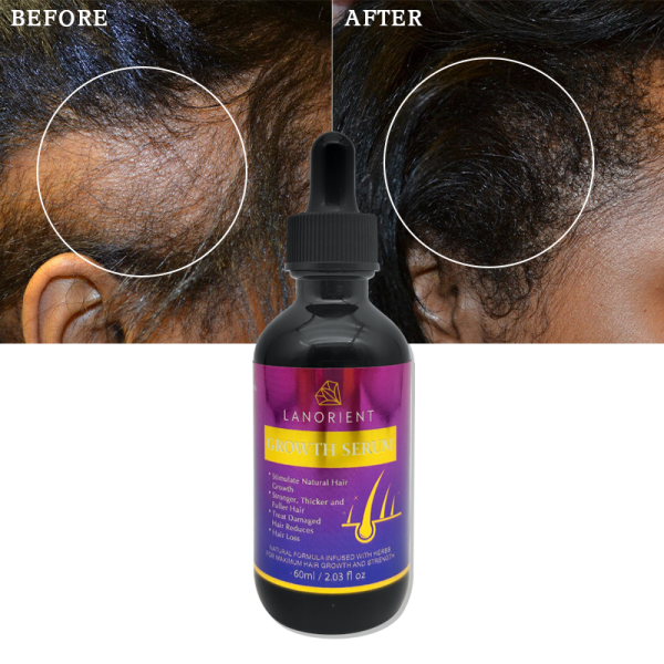 OEM Custom Logo Organic Hair Growth Care Set Naturally Promotes Hair Growth Rosemary Batana Oil