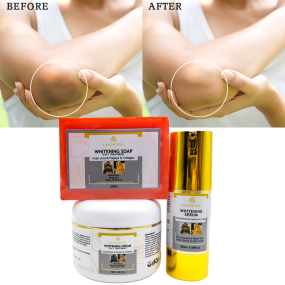 Private Label Korean Skin Beauty Products Natural Organic Vitamin C Knuckle Whitening Remove Dark Spots Skin Care Set for Women