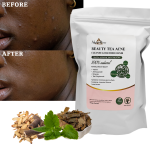 OEM Customization Health Care Products Natural Organic 100% Herbal Detox Beauty Tea for Acne