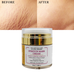 Private Label Natural Organic Body Care Products Vitamin E Rose Hip Oil Stretch Mark Removal Cream for Women