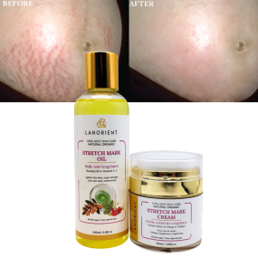 100% Pure Natural Herbal Body Care Products Organic Vitamin E Stretch Mark Removal Restore Skin Elasticity Stretch Mark Cream