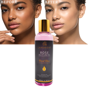 Private Label Natural Organic Skin Care Products Vitamin C Skin Whitening and Moisturizing Rosehip Oil for Face and Body