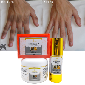 OEM Custom Skin Care Product Vitamin E L-Glutathione Whitening and Moisturizing Skin Care Set (New) for All Skin Types