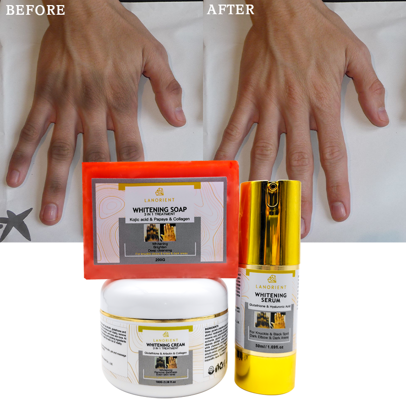 OEM Custom Skin Care Product Vitamin E L-Glutathione Whitening and Moisturizing Skin Care Set (New) for All Skin Types