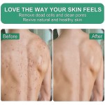 Exfoliating Mitts Factory - Custom Logo Dead Skin Remover