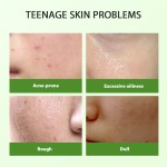 OEM ODM Private Label Women's Skin Care Set Tea Tree Oil Control and Shrink Pores Acne Barrier Facial Oil for Face Use