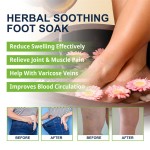 South Moon 10pcs Swelling Reducing Firming Orange Peel Tissue Repairing Joint Muscle Pain Relieving Herbal Soothing Foot Soak