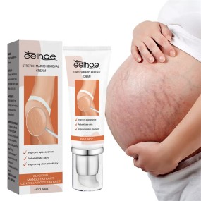 EELHOE 45g Stretch Marks Removal Cream Post Pregnancy Trace Removing Effective Stretch Mark Cream