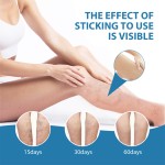 South Moon 30ml Herbal Relief Varicose Vein Remover Spray Soothing Moisturizing Varicose Veins Improving Spider Veins Removal