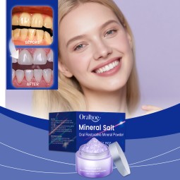 ORALHOE口腔修复矿物盐牙齿粉薰衣草牙齿抛光美白牙科用品商店