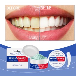 ORALHOE美白助齿剂玉米淀粉薄荷提取物深层清洁清新牙齿粉顺滑牙齿汤匙