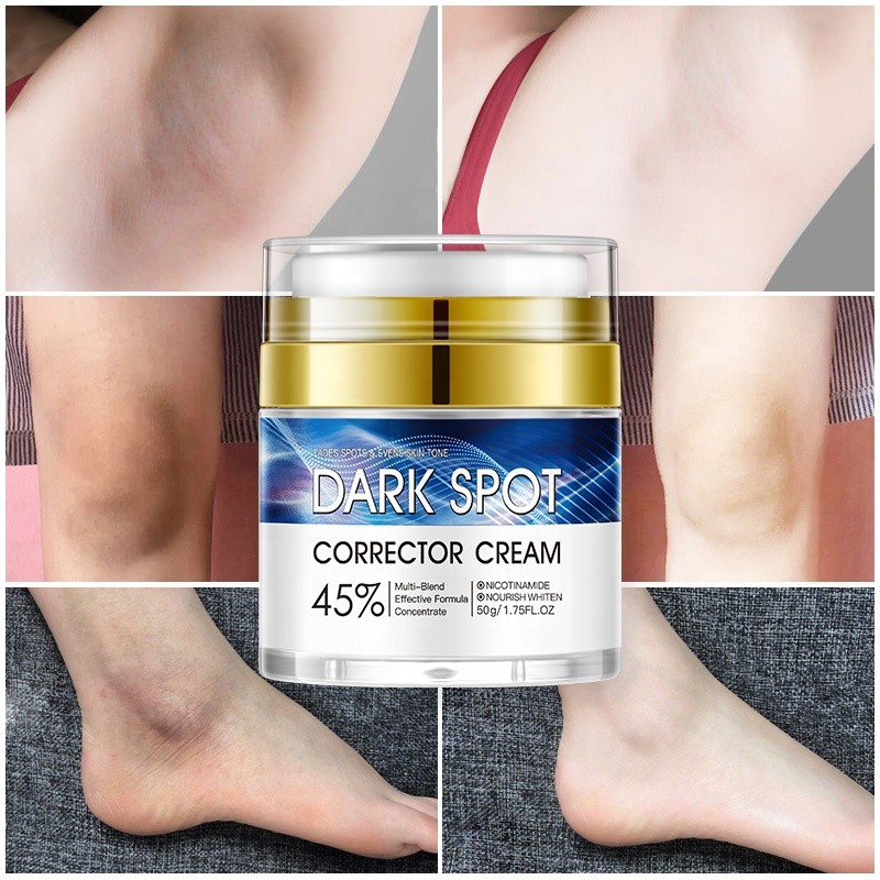Best Dark Spot Remover Body Sensitive Skin Whitening Cream Natural Instant Effect Intimate Area Underarm Brightening Cream