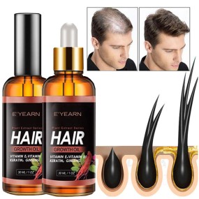 OEM High-Efficient Hair Growth Oil Ginseng Scalp Oil Anti-Hair Loss Scalp Nourishing Serum for Thicker Fuller Hair Treatment