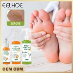 EELHOE脚去皮喷雾天然橙精华足疗手死皮去角质面膜美白婴儿脚护理喷雾