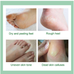 MABREM Foot Care Cream Long-Lasting Soft Rough Skin Moisturizing Foot Charm Calendula Soft Moisturizing Foot Cream
