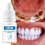 OEM自有品牌多用途牙齿美白配件去除牙菌斑污渍口腔卫生清洁血清牙齿漂白