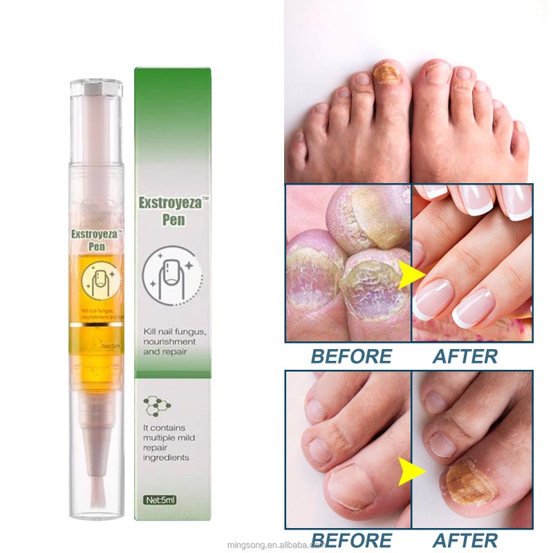 Wholesale Cheapest Fungal Nail Therapy Pen for Professional Nail Repair 5ml